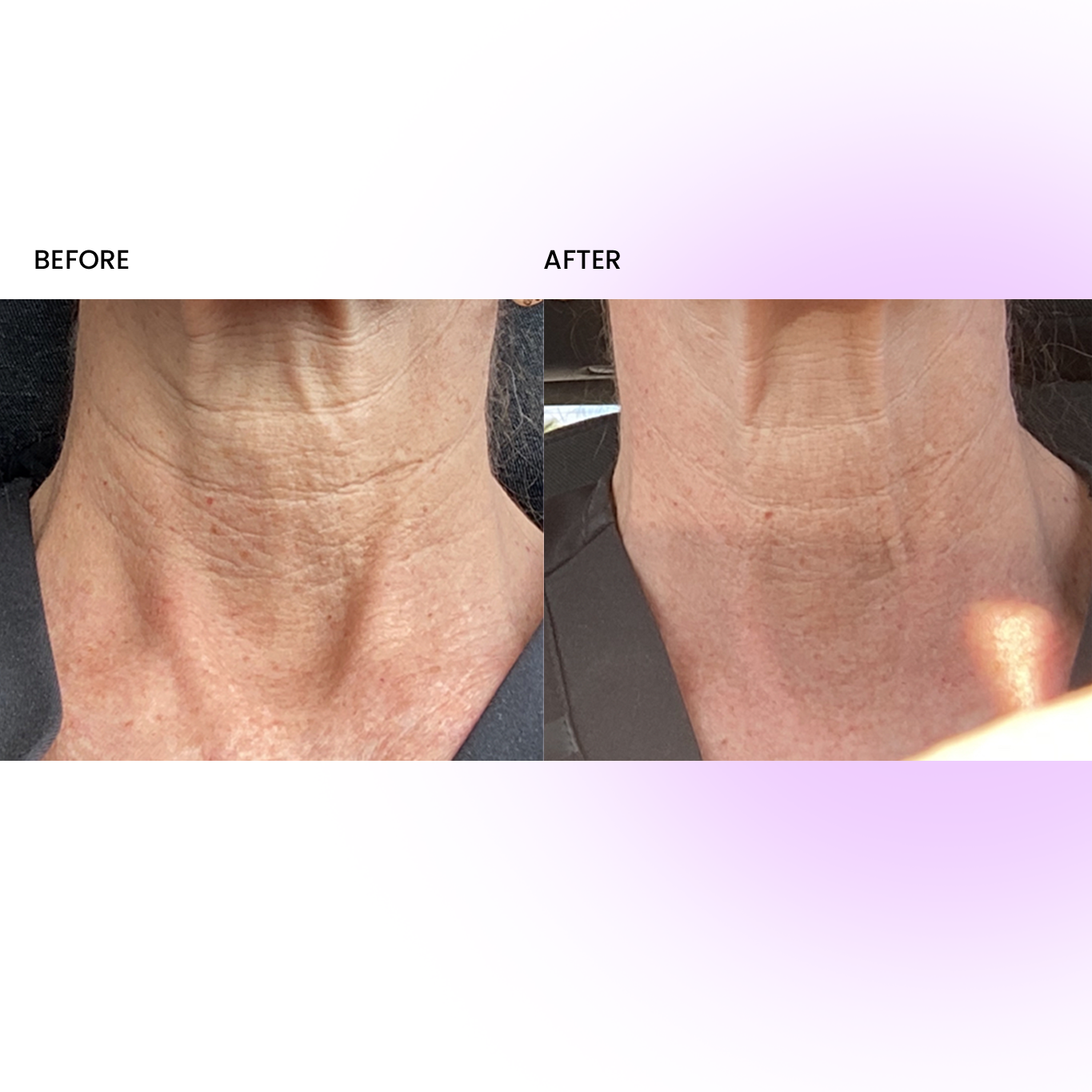 NECK+ Regenerative Cream