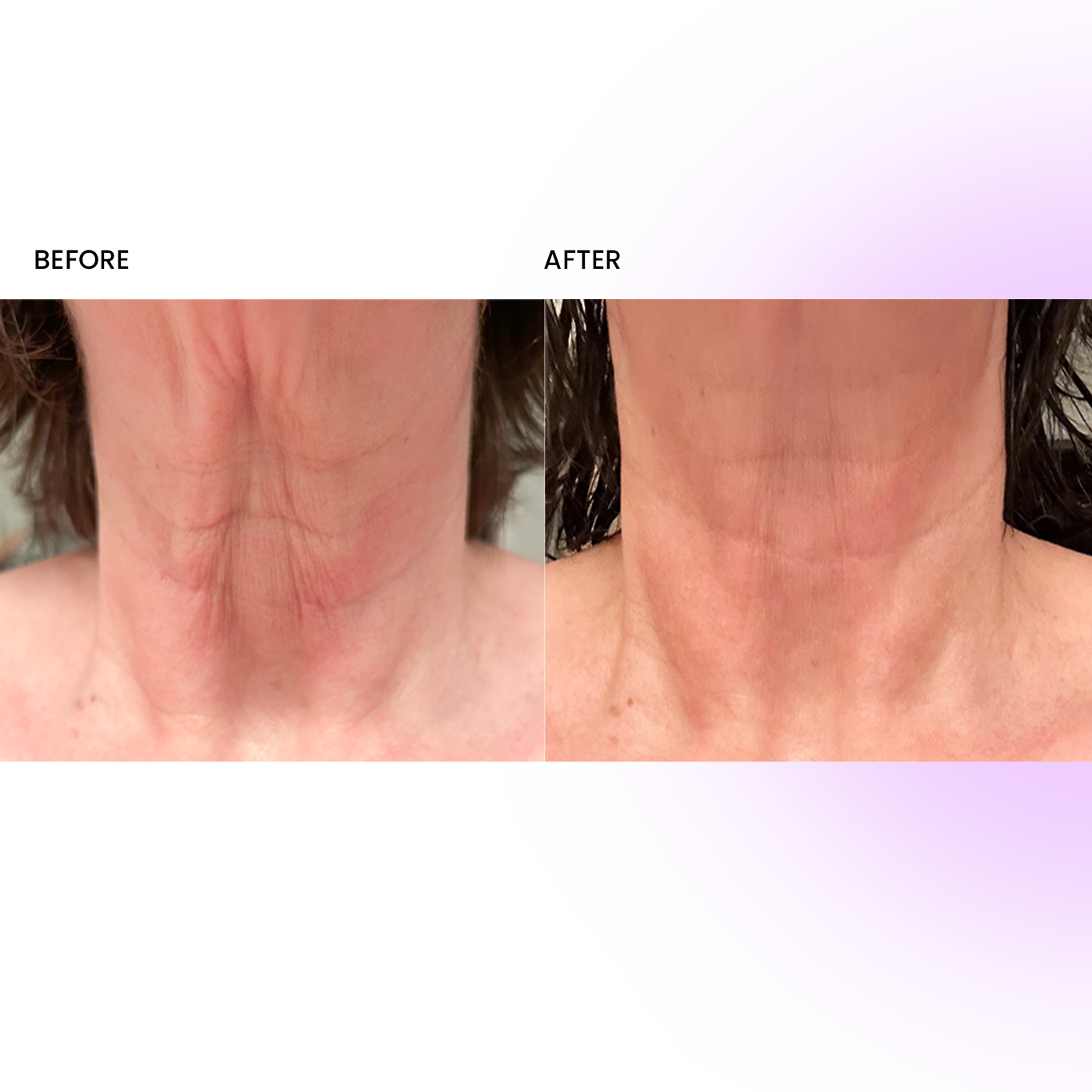 NECK+ Regenerative Cream