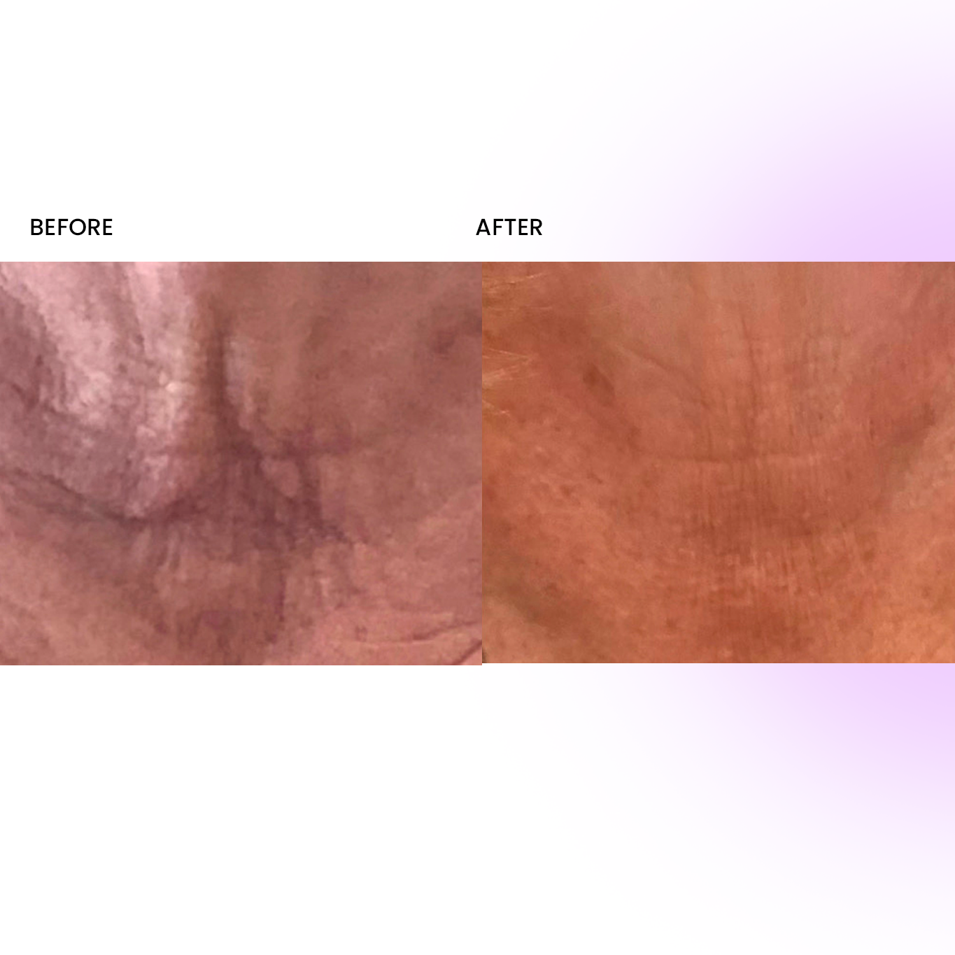 NECK+ Regenerative Cream